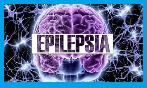 El padecer epilepsia en el país podría ser muy alto