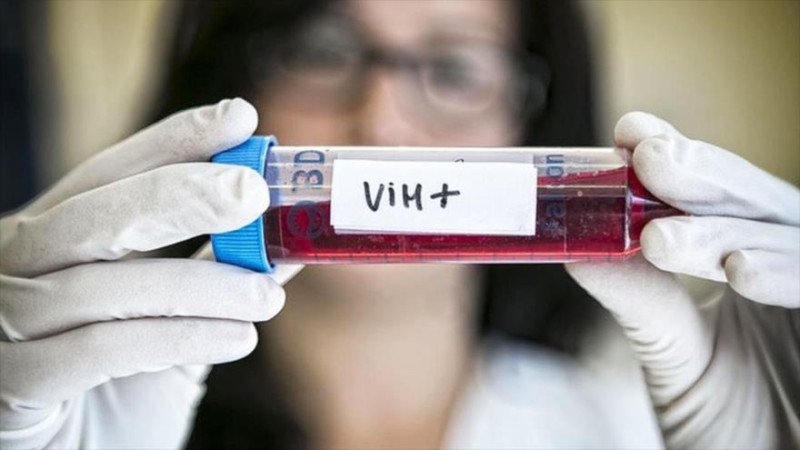 VIH/SIDA en República Dominicana: Avances y desafíos en la lucha contra el virus