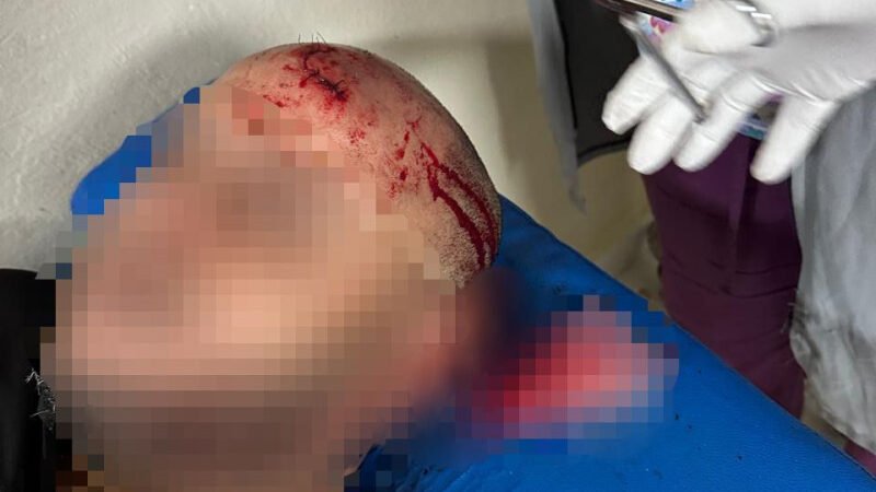 Denuncian que indocumentados agreden agentes en Puerto Plata