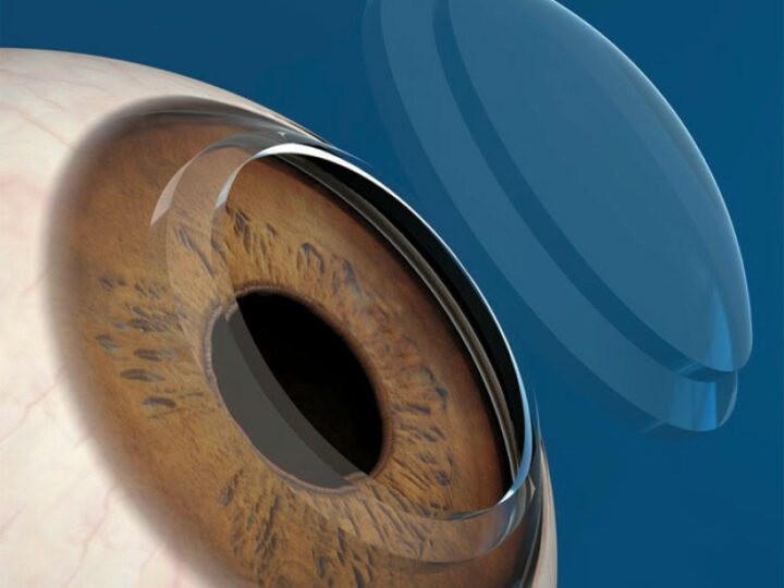  Activarán bancos de donación en dos hospitales