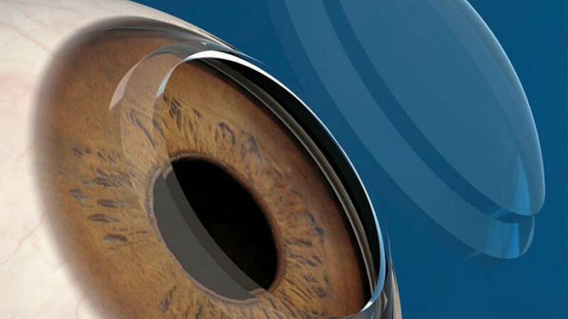  Activarán bancos de donación en dos hospitales