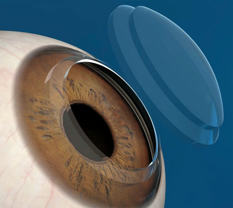  Activarán bancos de donación en dos hospitales