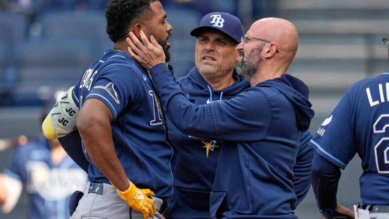 Junior Caminero con contusión en la mandíbula