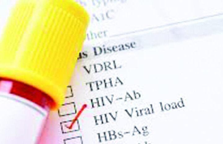 SNS informa un total de 56,967 pacientes con VIH