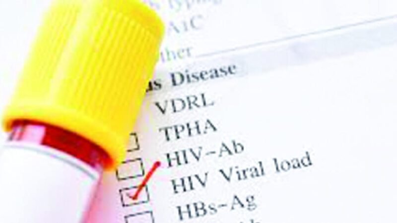 SNS informa un total de 56,967 pacientes con VIH