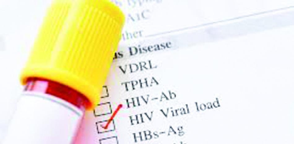SNS informa un total de 56,967 pacientes con VIH