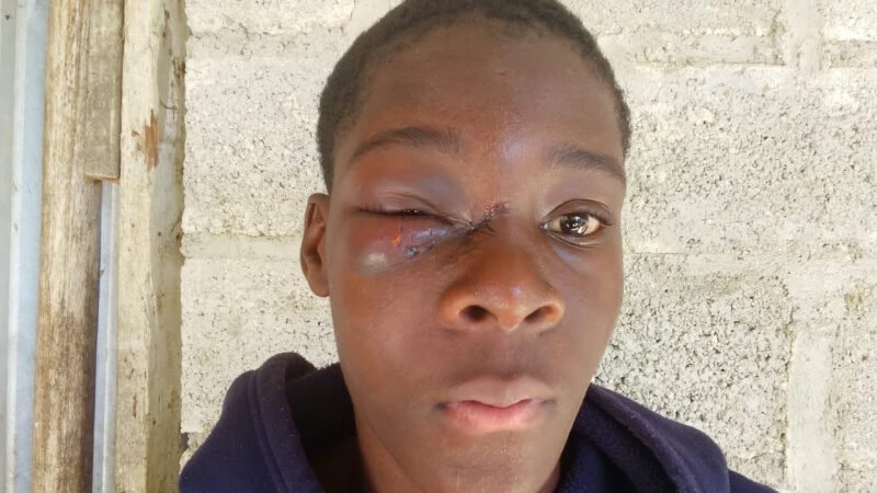 Otra agresión policial en un ojo de un joven durante operativo en San Luis